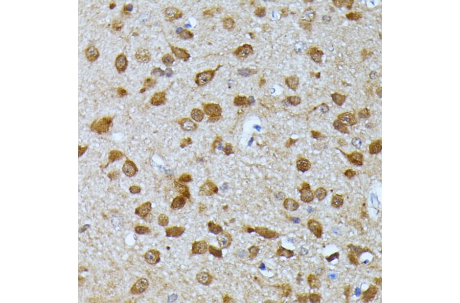 Immunohistochemistry - Anti-Ubiquitin Antibody (A14408) - Antibodies.com