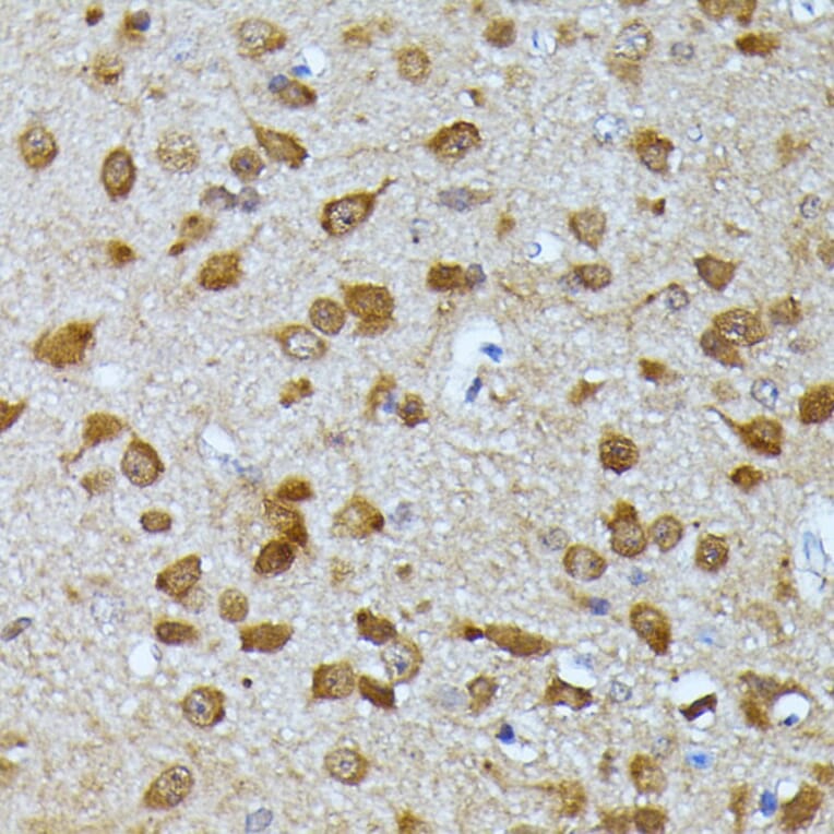 Immunohistochemistry - Anti-Ubiquitin Antibody (A14408) - Antibodies.com
