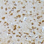 Immunohistochemistry - Anti-Ubiquitin Antibody (A14408) - Antibodies.com