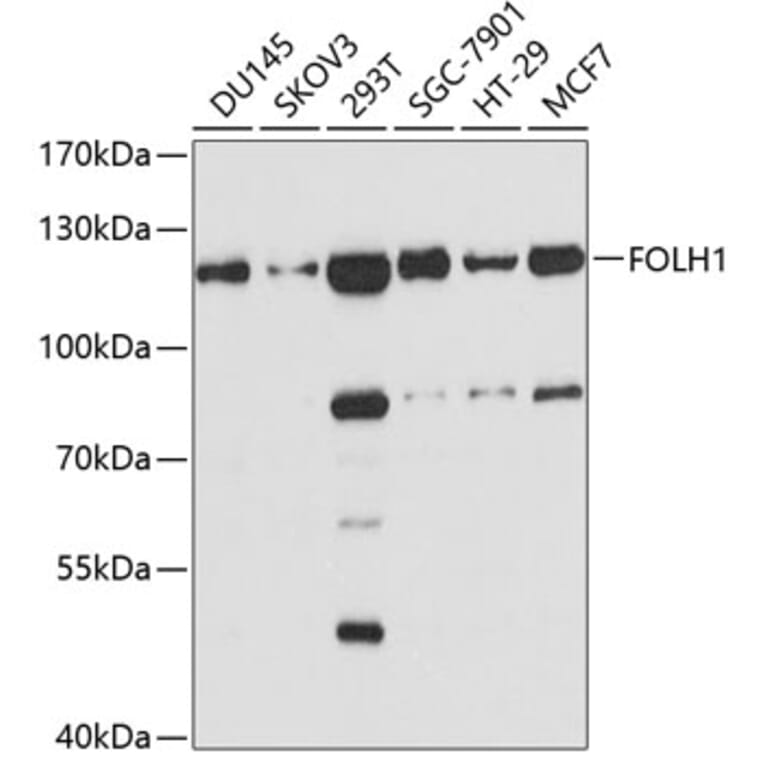 Western Blot - Anti-FOLH1 Antibody (A3220) - Antibodies.com