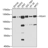 Western Blot - Anti-FOLH1 Antibody (A3220) - Antibodies.com