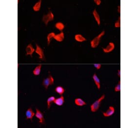 Immunofluorescence - Anti-CamKII gamma Antibody (A14411) - Antibodies.com