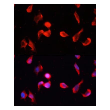 Immunofluorescence - Anti-CamKII gamma Antibody (A14411) - Antibodies.com