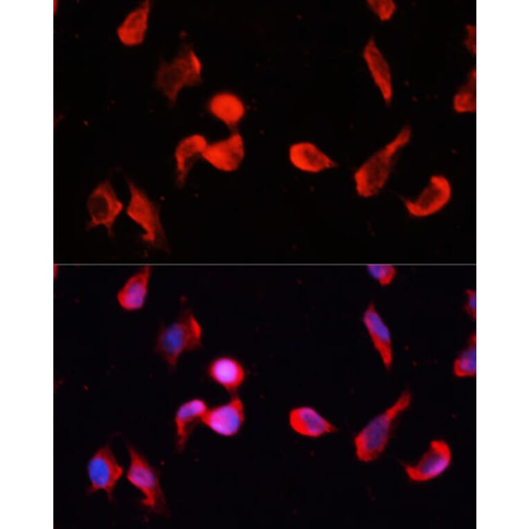 Immunofluorescence - Anti-CamKII gamma Antibody (A14411) - Antibodies.com