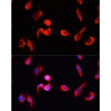 Immunofluorescence - Anti-CamKII gamma Antibody (A14411) - Antibodies.com