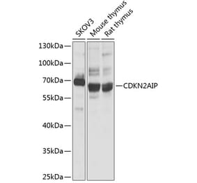 Western Blot - Anti-CDKN2AIP Antibody (A14412) - Antibodies.com