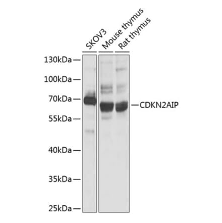 Western Blot - Anti-CDKN2AIP Antibody (A14412) - Antibodies.com