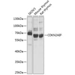 Western Blot - Anti-CDKN2AIP Antibody (A14412) - Antibodies.com