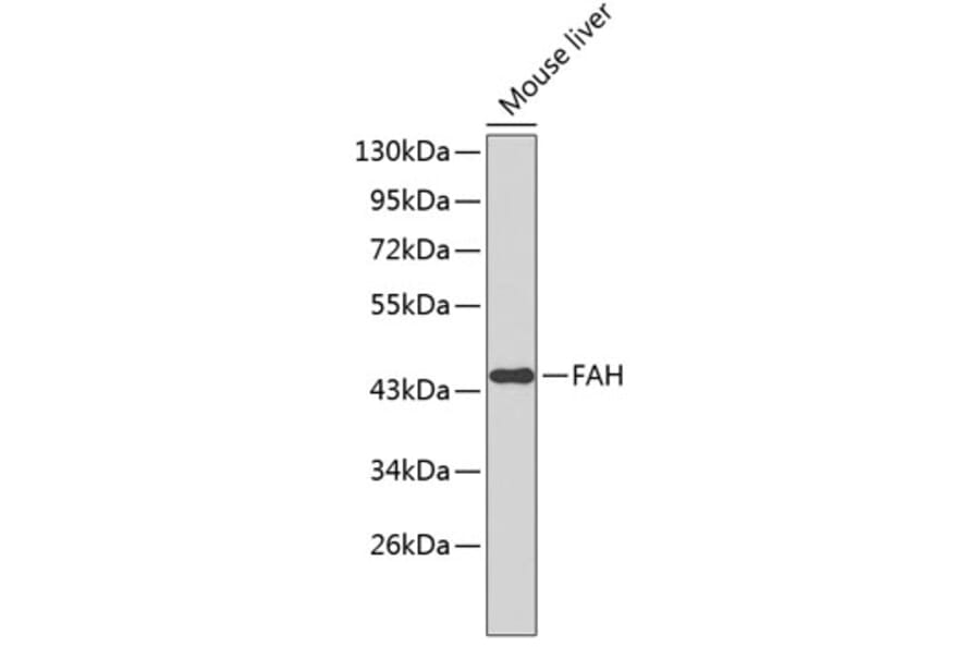 Western Blot - Anti-FAH Antibody (A3238) - Antibodies.com