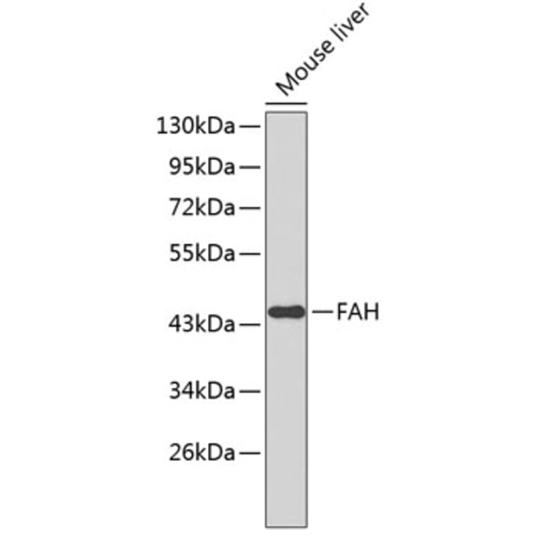 Western Blot - Anti-FAH Antibody (A3238) - Antibodies.com