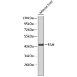 Western Blot - Anti-FAH Antibody (A3238) - Antibodies.com