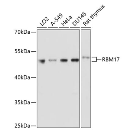 Western Blot - Anti-SPF45 Antibody (A14414) - Antibodies.com