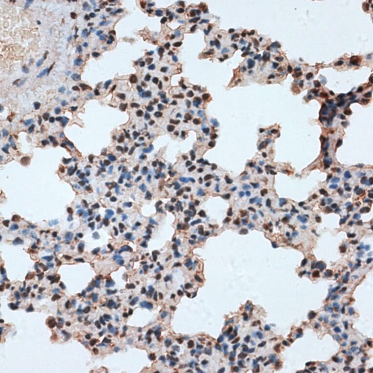 Immunohistochemistry - Anti-SPF45 Antibody (A14414) - Antibodies.com