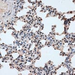 Immunohistochemistry - Anti-SPF45 Antibody (A14414) - Antibodies.com