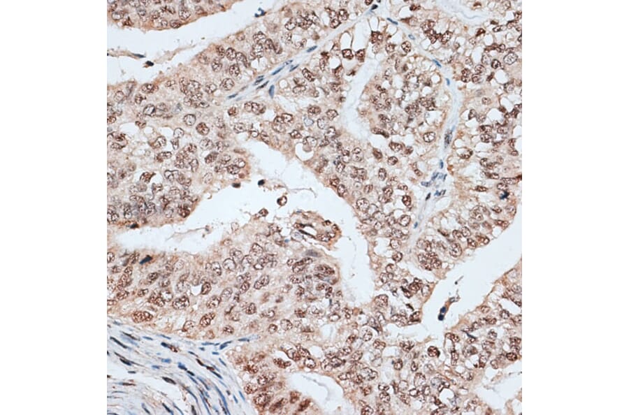 Immunohistochemistry - Anti-SPF45 Antibody (A14414) - Antibodies.com