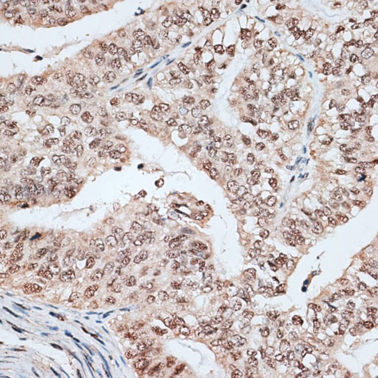 Immunohistochemistry - Anti-SPF45 Antibody (A14414) - Antibodies.com