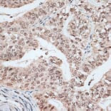 Immunohistochemistry - Anti-SPF45 Antibody (A14414) - Antibodies.com