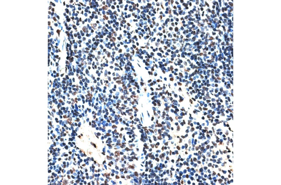 Immunohistochemistry - Anti-SPF45 Antibody (A14414) - Antibodies.com