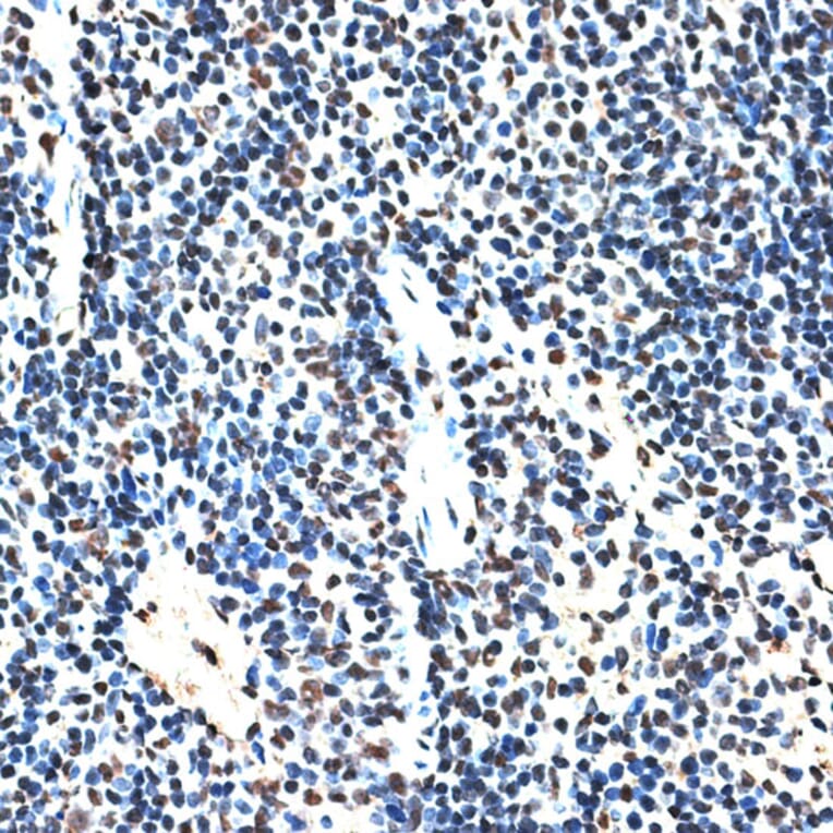 Immunohistochemistry - Anti-SPF45 Antibody (A14414) - Antibodies.com