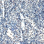 Immunohistochemistry - Anti-SPF45 Antibody (A14414) - Antibodies.com