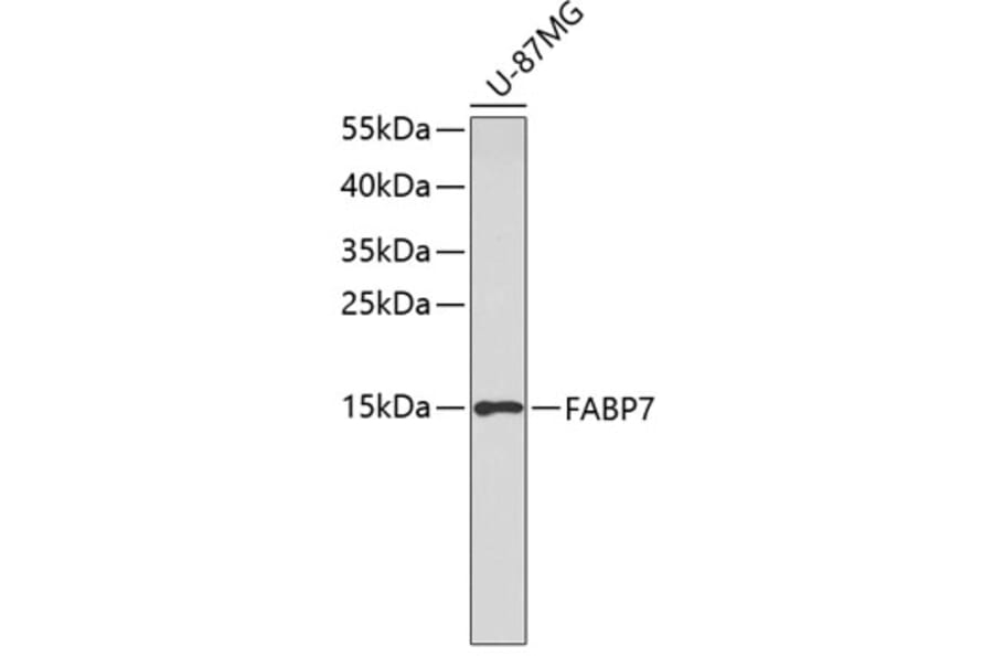 Western Blot - Anti-FABP7 Antibody (A3246) - Antibodies.com