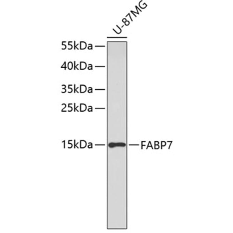 Western Blot - Anti-FABP7 Antibody (A3246) - Antibodies.com