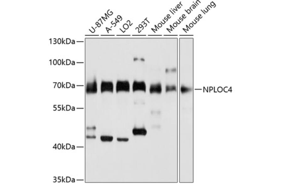 Western Blot - Anti-NPL4 Antibody (A14416) - Antibodies.com