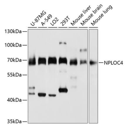 Western Blot - Anti-NPL4 Antibody (A14416) - Antibodies.com