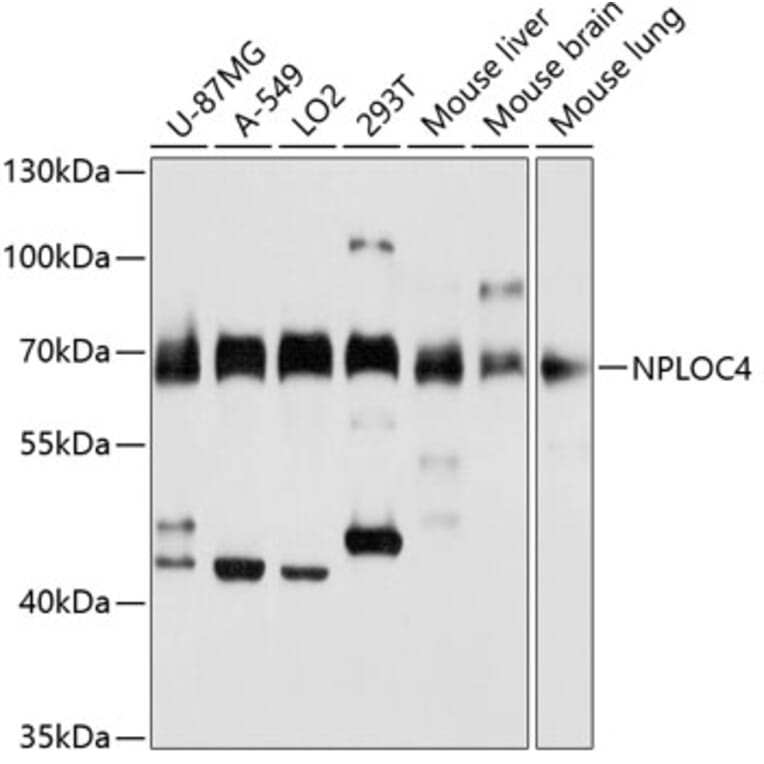 Western Blot - Anti-NPL4 Antibody (A14416) - Antibodies.com