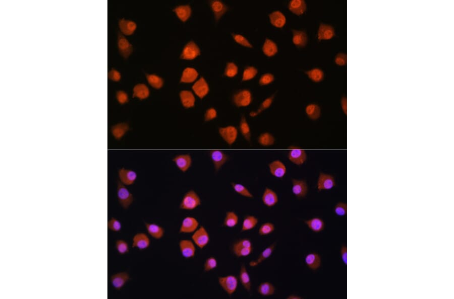 Immunofluorescence - Anti-NPL4 Antibody (A14416) - Antibodies.com