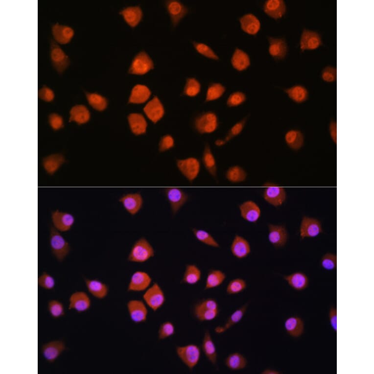 Immunofluorescence - Anti-NPL4 Antibody (A14416) - Antibodies.com