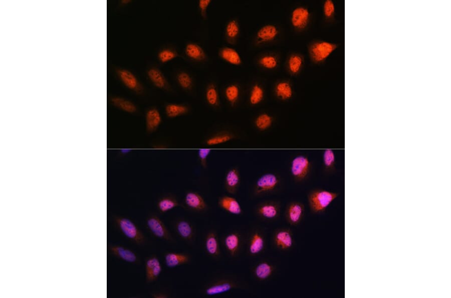 Immunofluorescence - Anti-NPL4 Antibody (A14416) - Antibodies.com