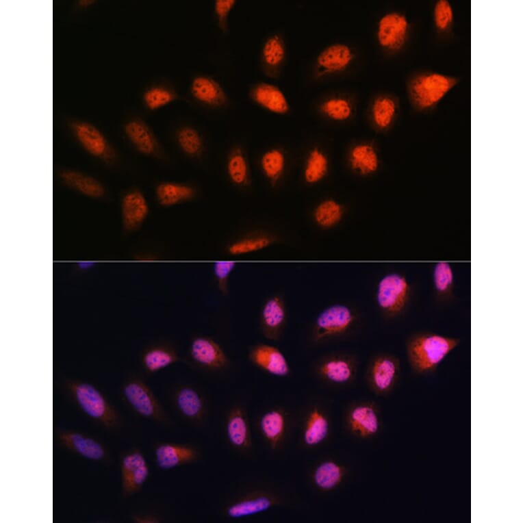 Immunofluorescence - Anti-NPL4 Antibody (A14416) - Antibodies.com