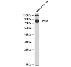 Western Blot - Anti-PAK1 Antibody (A14420) - Antibodies.com