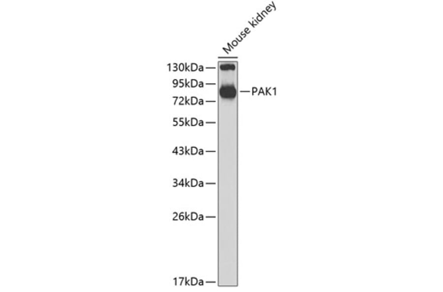 Western Blot - Anti-PAK1 Antibody (A14420) - Antibodies.com