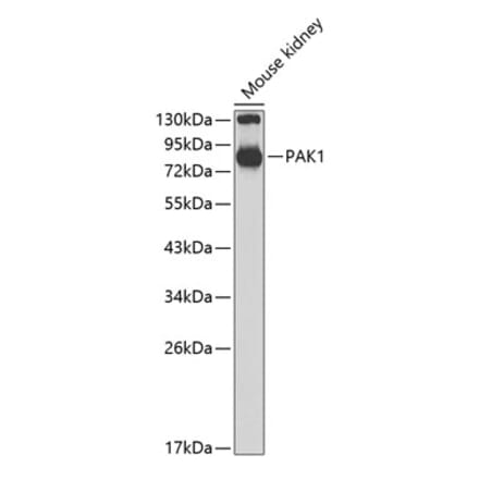 Western Blot - Anti-PAK1 Antibody (A14420) - Antibodies.com