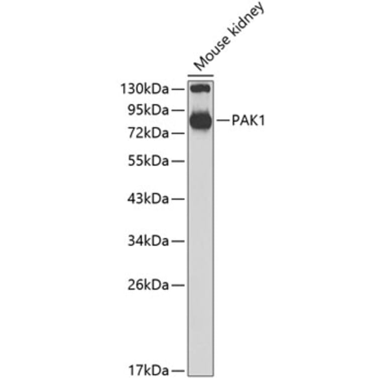 Western Blot - Anti-PAK1 Antibody (A14420) - Antibodies.com