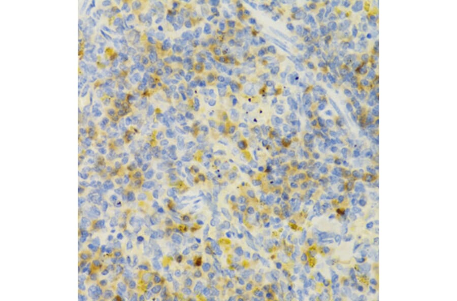 Immunohistochemistry - Anti-PAK1 Antibody (A14420) - Antibodies.com