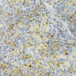 Immunohistochemistry - Anti-PAK1 Antibody (A14420) - Antibodies.com