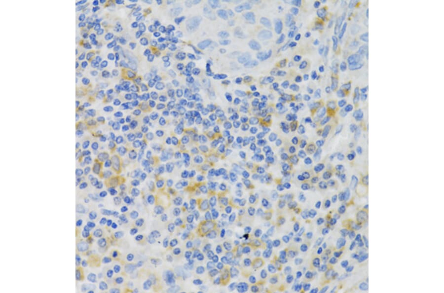 Immunohistochemistry - Anti-PAK1 Antibody (A14420) - Antibodies.com
