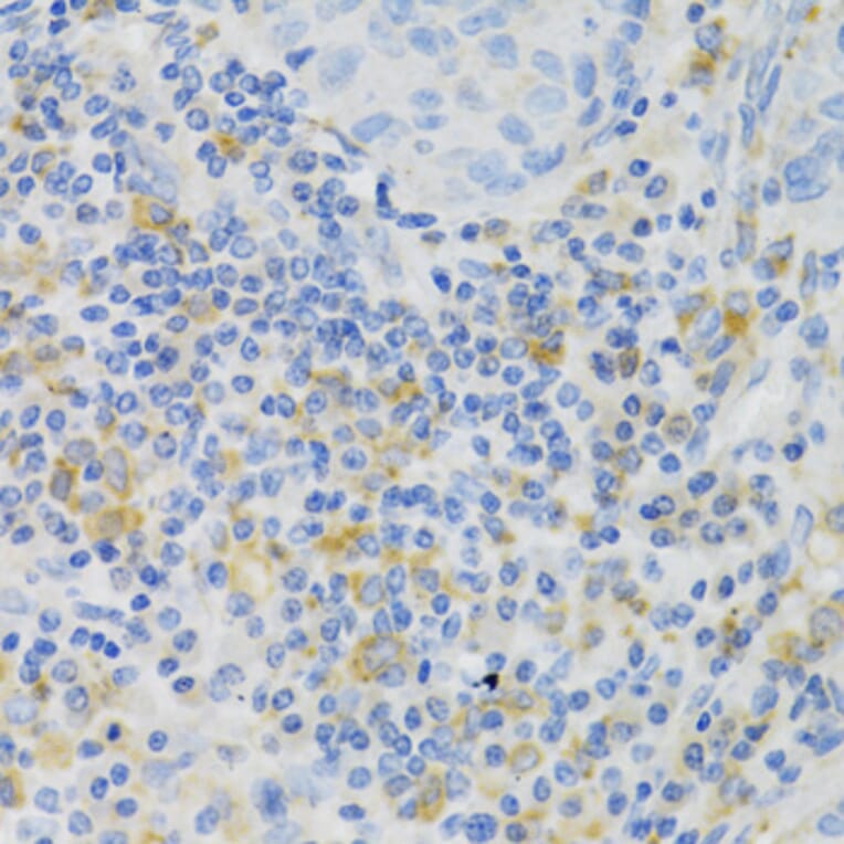 Immunohistochemistry - Anti-PAK1 Antibody (A14420) - Antibodies.com