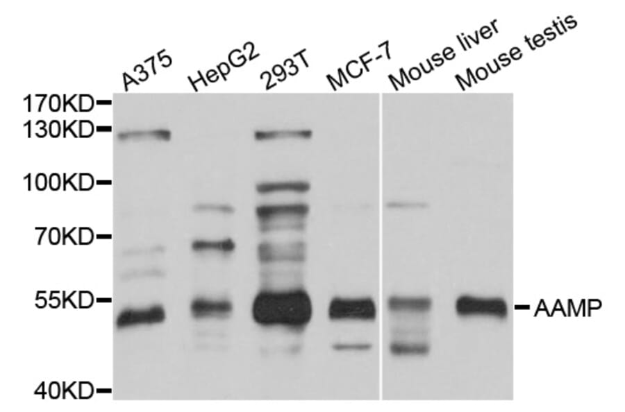 Western Blot - Anti-AAMP Antibody (A3283) - Antibodies.com