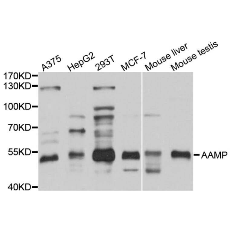 Western Blot - Anti-AAMP Antibody (A3283) - Antibodies.com