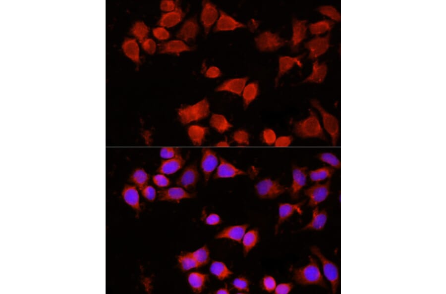Immunofluorescence - Anti-AAMP Antibody (A3283) - Antibodies.com