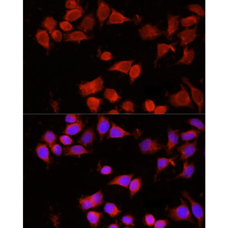 Immunofluorescence - Anti-AAMP Antibody (A3283) - Antibodies.com