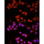 Immunofluorescence - Anti-AAMP Antibody (A3283) - Antibodies.com