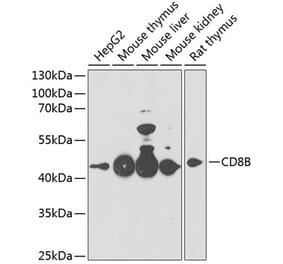 Western Blot - Anti-CD8 beta Antibody (A14422) - Antibodies.com