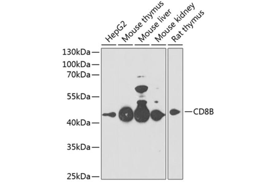 Western Blot - Anti-CD8 beta Antibody (A14422) - Antibodies.com