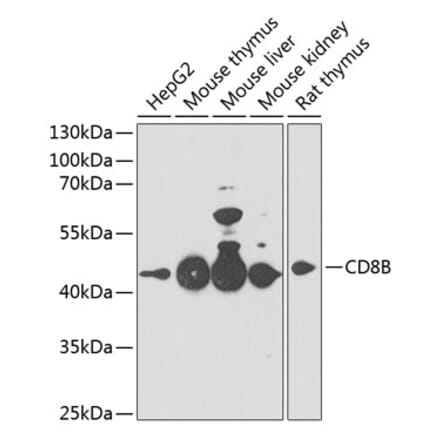 Western Blot - Anti-CD8 beta Antibody (A14422) - Antibodies.com