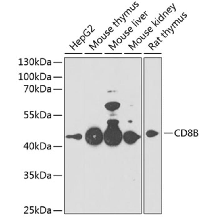 Western Blot - Anti-CD8 beta Antibody (A14422) - Antibodies.com